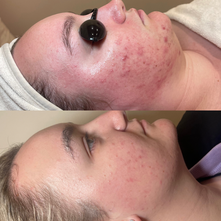 Oneeka Skin Care – Oneeka Skincare